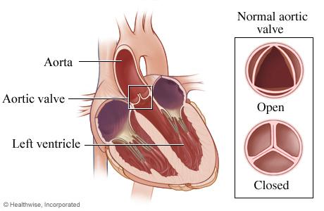 Heart valves: Diagrams, types, function, diseases, and more
